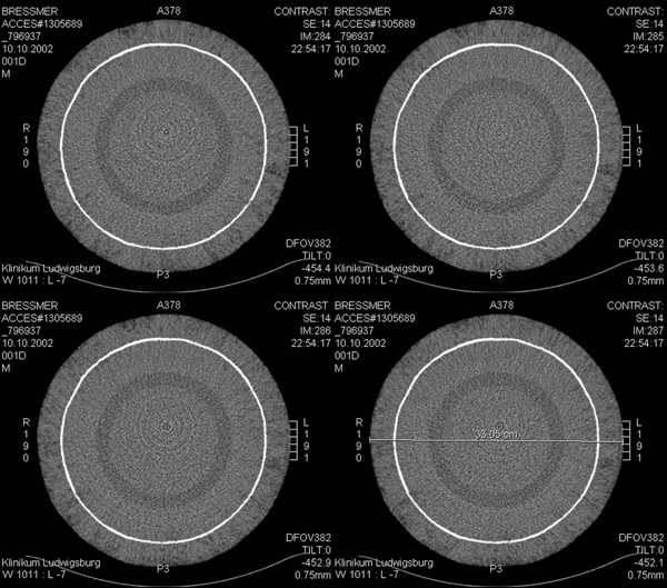 genetic fingerprint 006a