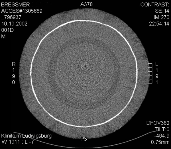 genetic fingerprint 006b